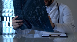 Bukti Ilmiah Peran Steroid pada Cedera Medula Spinalis Akut