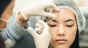 Injeksi Kortikosteroid Intralesi untuk Acne Vulgaris