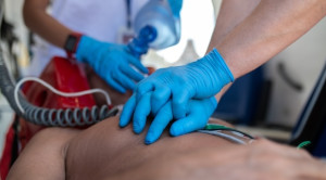 Durasi Resusitasi Jantung Paru pada Henti Jantung – Telaah Jurnal Alomedika