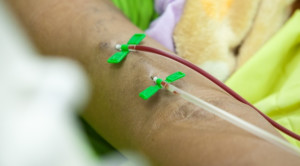 Studi WAVE pada Pasien Hemodialisis dengan Stenosis Fistula Arteriovenosa – Telaah Jurnal Alomedika