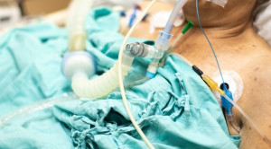 Perburukan Kondisi Pasien dengan Komorbiditas Kardiovaskular Akibat Infeksi RSV