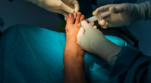 Anestesi Blok Saraf Digiti yang Adekuat untuk Ekstraksi Kuku