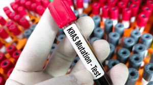 Efektivitas Kit Diagnostik Molekuler untuk Kanker Kolorektal