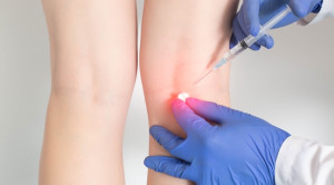 Injeksi Kortikosteroid Vs Dry Needling untuk Nyeri Muskuloskeletal