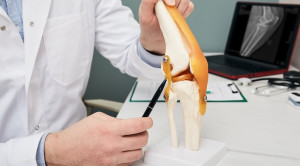 Perbandingan Terapi Konservatif dan Pembedahan pada Penanganan Cedera ACL