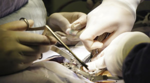 Perlukah Profilaksis DVT untuk Operasi Tulang Belakang