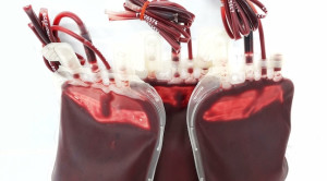 Pedoman Tata Laksana Transfusion-Dependent β-Thalassemia – Ulasan Guideline Terkini