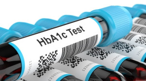 HbA1c sebagai Penanda Diagnosis, Prognosis, dan Komplikasi pada Diabetes Mellitus Tipe 2