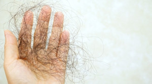 Scalp Cooling Sebagai Alternatif Pencegahan Alopecia Terkait Kemoterapi