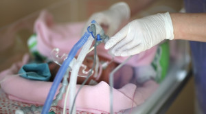 Kafein, Teofilin, atau Aminofilin untuk Apnea pada Bayi Preterm