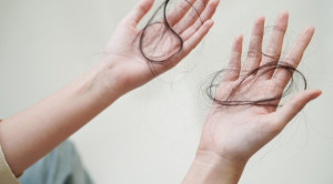 Pedoman Penanganan Kerontokan Rambut di Fasilitas Kesehatan Primer – Ulasan Guideline Terkini