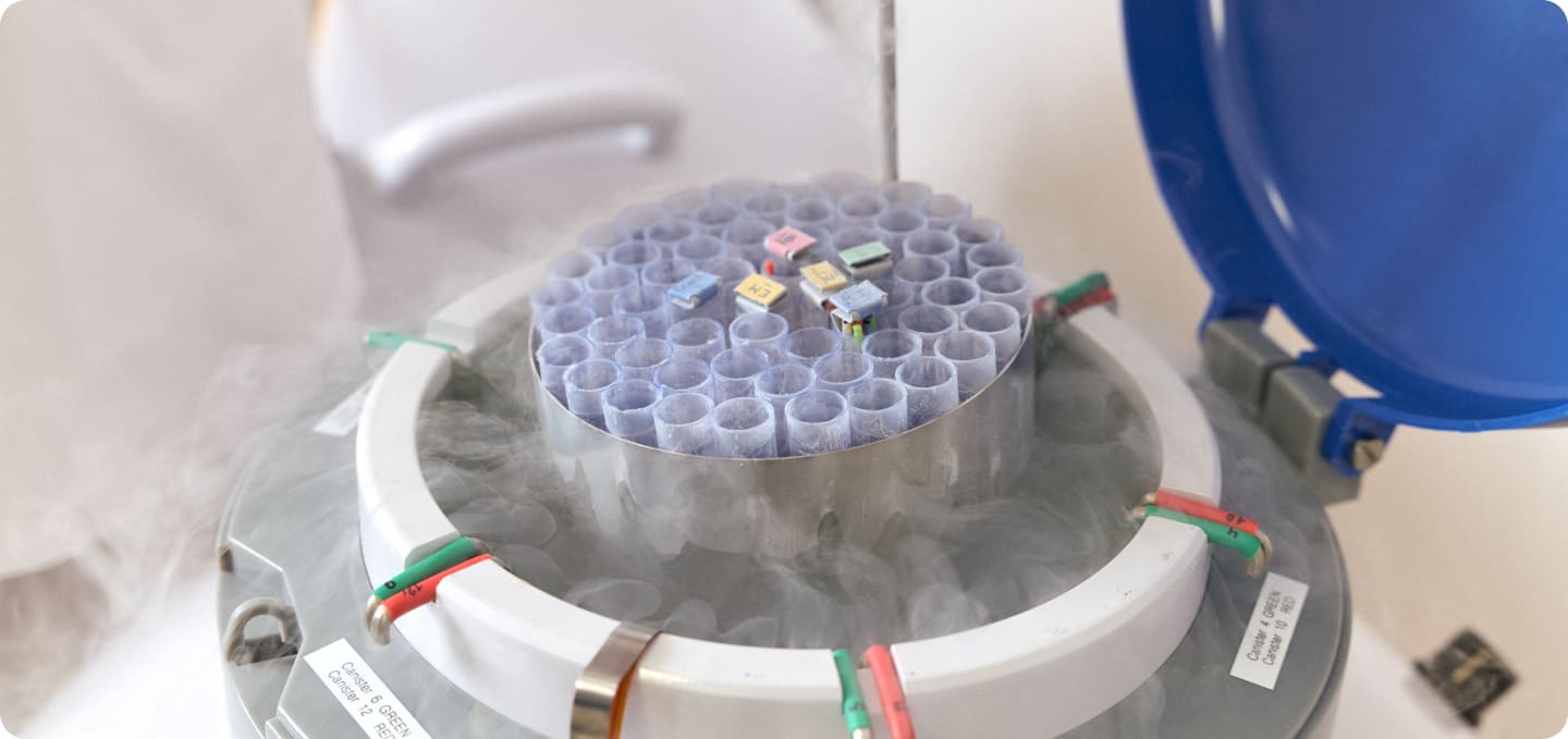 storage of frozen eggs