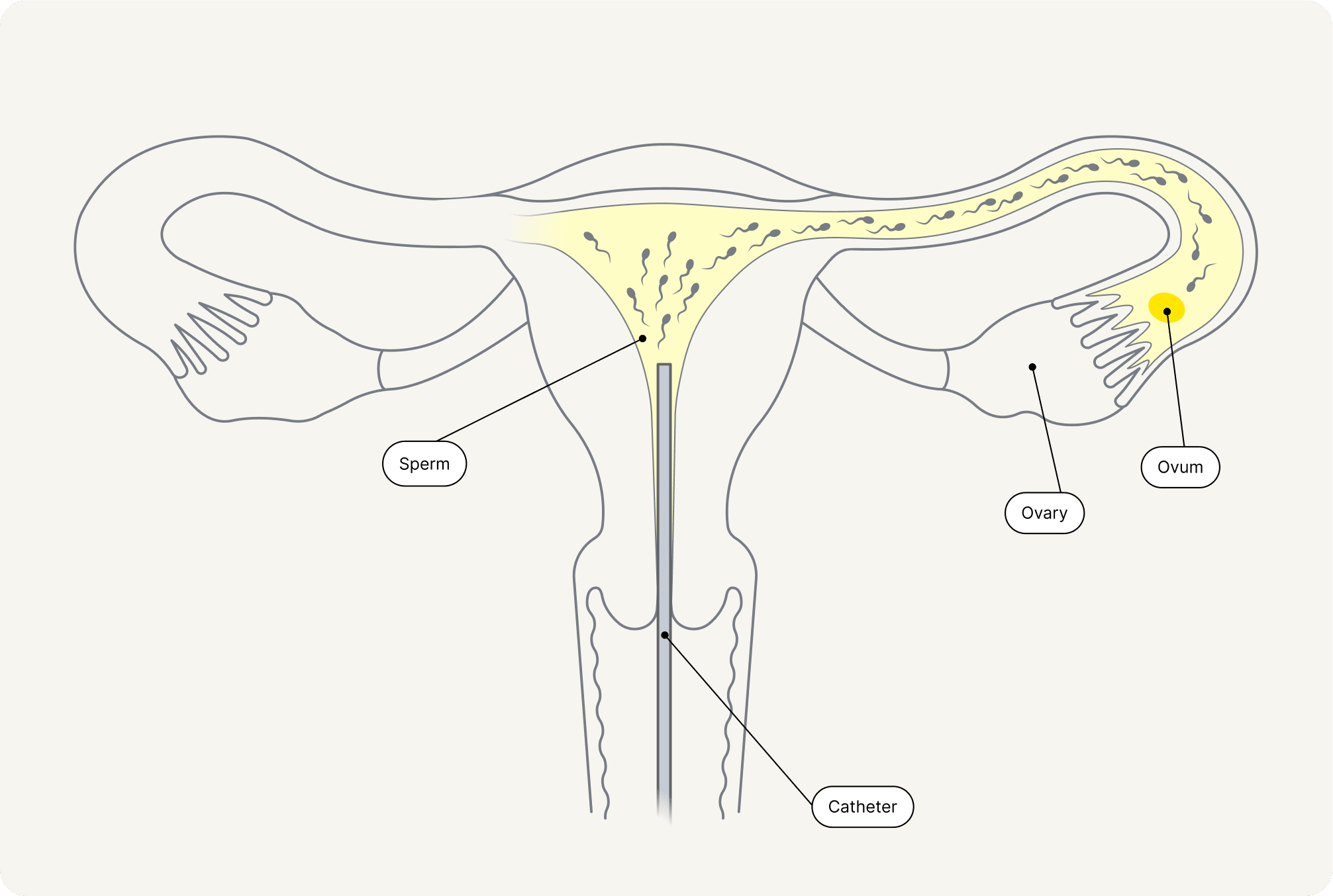 Process of insemination