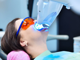 Eine Frau bleacht ihre Zähne, sie hält dafür ein kleines Bleachinggerät mit blauem Licht an ihren Mund.