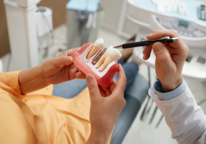 Eine Patientin auf dem Zahnarztstuhl hält ein Teilmodel des Kiefers mit Implantat. Die Hand des Zahnarztes deutet darauf und erklärt.