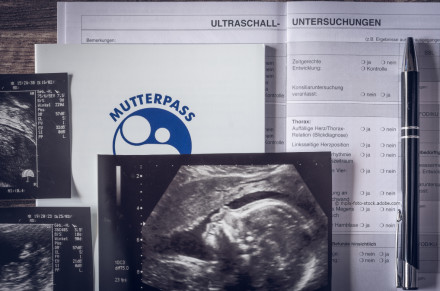 Ein Bild zeigt mehrere Ultraschallbilder und ein ärztliches Dokument. Im Vordergrund liegt ein Mutterpass mit einem blauen Symbol darauf. Ein Kugelschreiber befindet sich auf dem Dokument mit der Überschrift "Ultraschall-Untersuchungen".