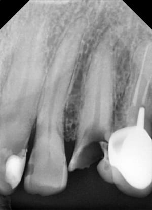 Ça a l air facile ppmgu6 - Eugenol