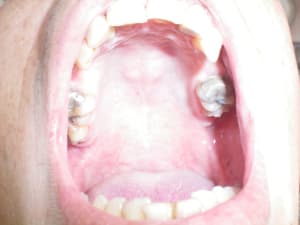 005 ornvog - Eugenol