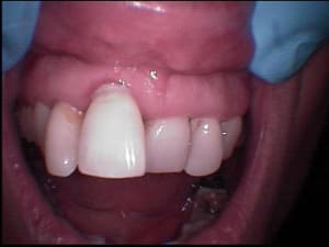 007  4  ibgngk - Eugenol