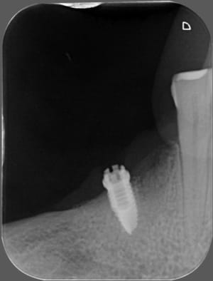 00892 x 2011 08 16 14 18 02 4 akqet0 - Eugenol