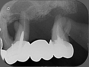 01106 x 2011 08 29 16 38 46 4 c4wffb - Eugenol