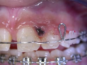 01694514 qlaa0a - Eugenol