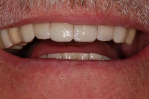 036 sv2k6z - Eugenol