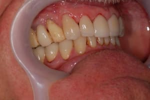 038 fmd8bs - Eugenol