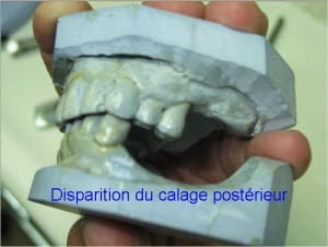03 calage post nul rbqgoq - Eugenol