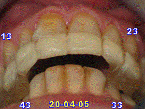 050420 rmda c3nlpw - Eugenol