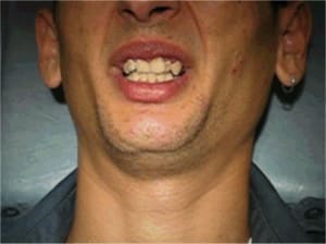 051017 dldegl dlepsm - Eugenol