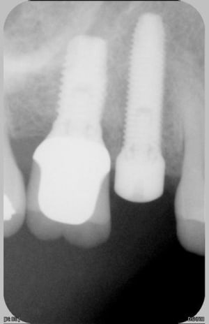081 jpeg wado3b - Eugenol