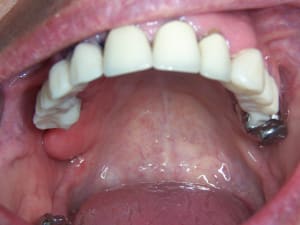 09 07 01positdental  061 cpkfhz - Eugenol