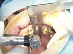 100 7716 wmj2pq - Eugenol