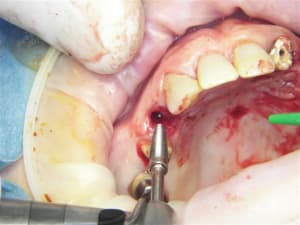 100 7774 jvvxpw - Eugenol