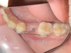 10882 3bis i0okr7 - Eugenol