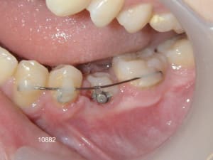 10882 7bis glm4xv - Eugenol