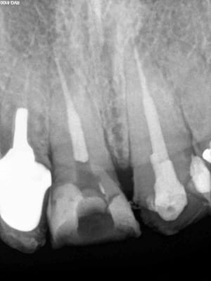 11 21 endo turbo so1akt - Eugenol