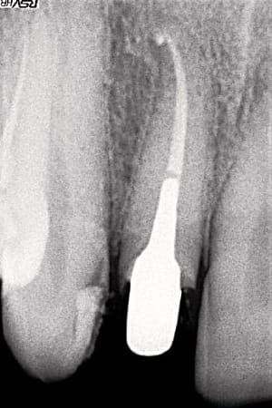 12pic wtc91l - Eugenol