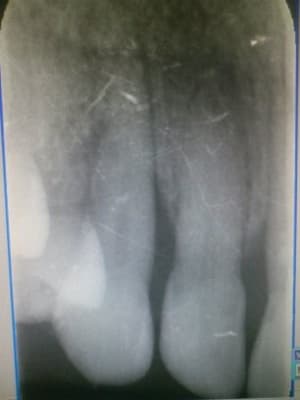 1365237128317 rfn0wt - Eugenol