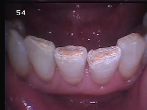 141 do0s3w - Eugenol