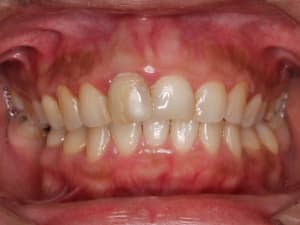 15 frymgw - Eugenol