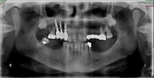 17 lb5ppl - Eugenol