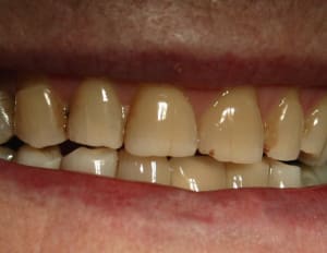 18 sourire wrnjhx - Eugenol