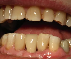 19 pose gtoxuz - Eugenol