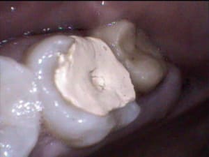 1 lqne8e - Eugenol