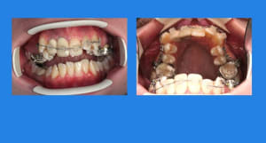 1 q4hjp9 - Eugenol