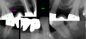 2005 rx rutpjq - Eugenol