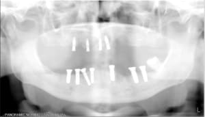 2007 02 is9yow - Eugenol