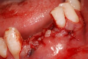 2007 06 23 014 cmq0bd - Eugenol